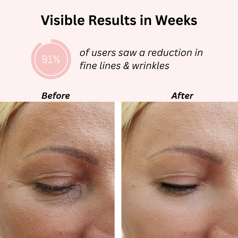 High Frequency Wand for Anti-Aging